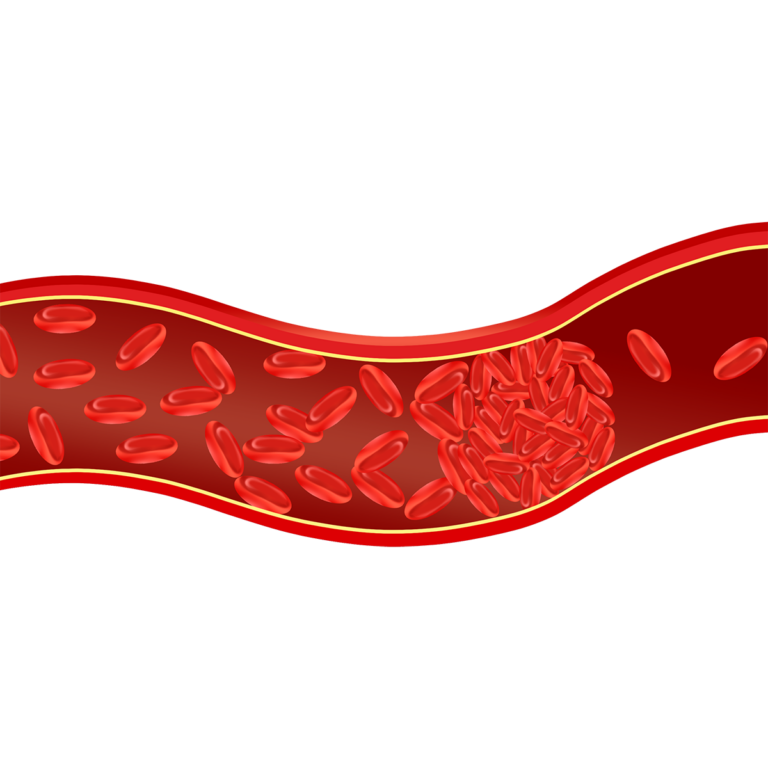 How to Treat Blood Clots First Aid Pro Adelaide