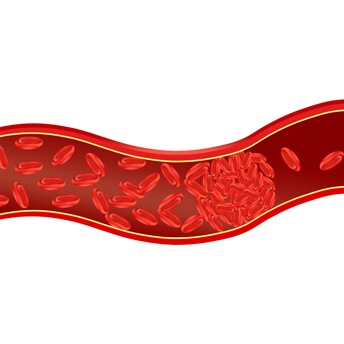 How to Treat Blood Clots First Aid Pro Adelaide