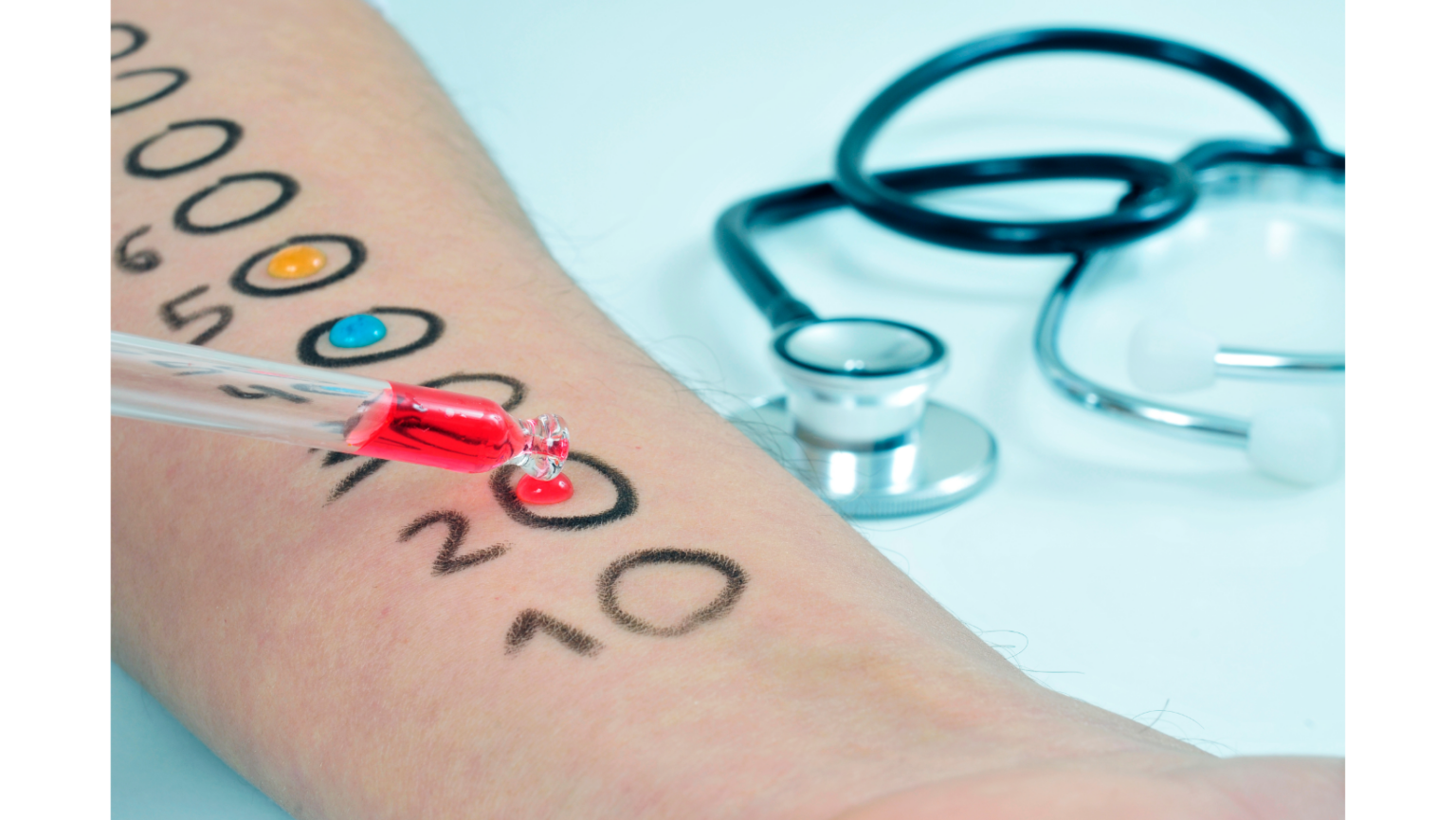 How to Get Rid of Skin Allergies First Aid Pro Adelaide