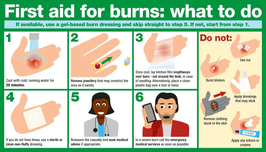 How to treat burns infographic