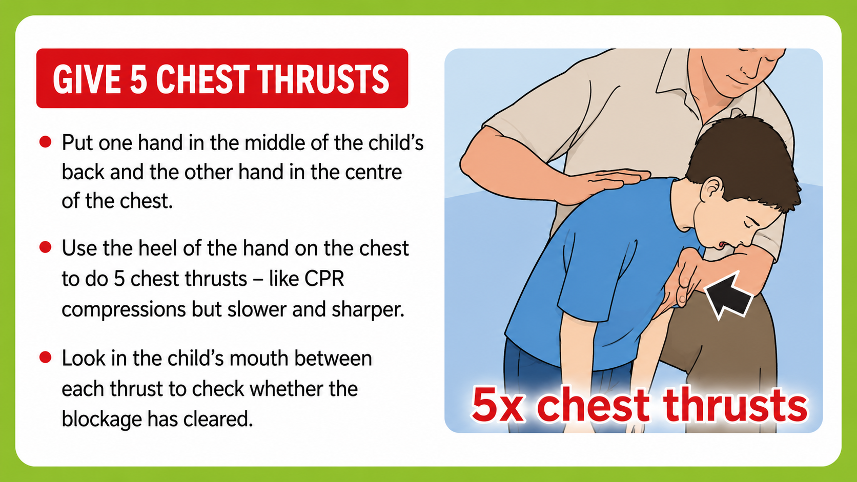 Chest thrusts for choking first aid