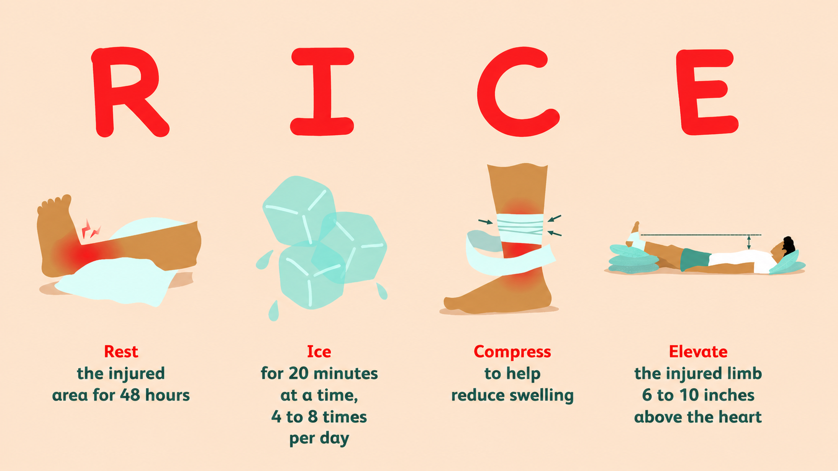 First aid for strains and sprains - RICE method